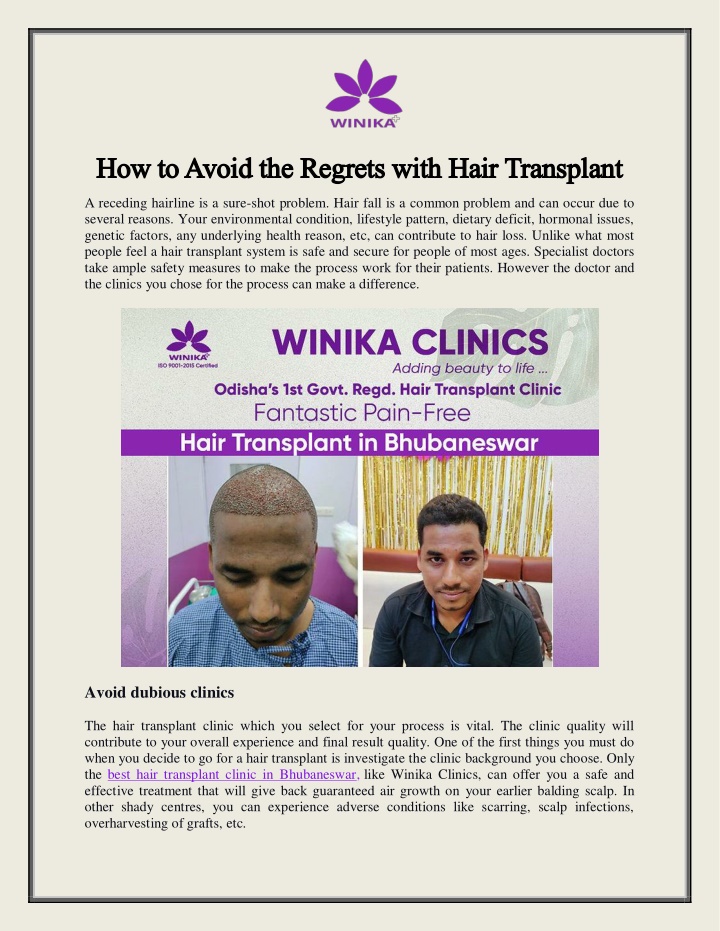 how to avoid the regrets with hair transplant