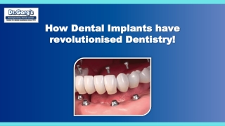 How Dental Implants have revolutionised Dentistry