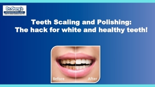 Teeth Scaling and Polishing The hack for white and healthy teeth!