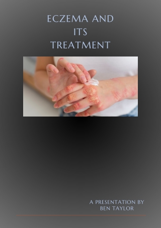 Eczema: A Comprehensive guide for its treatment.