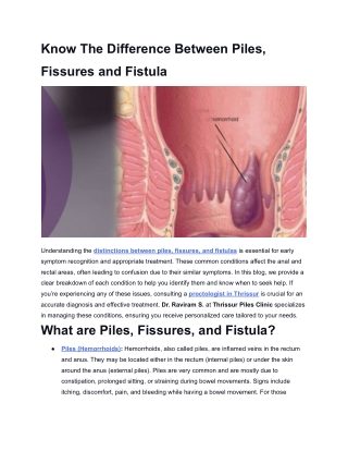 Know The Difference Between Piles, Fissures and Fistula