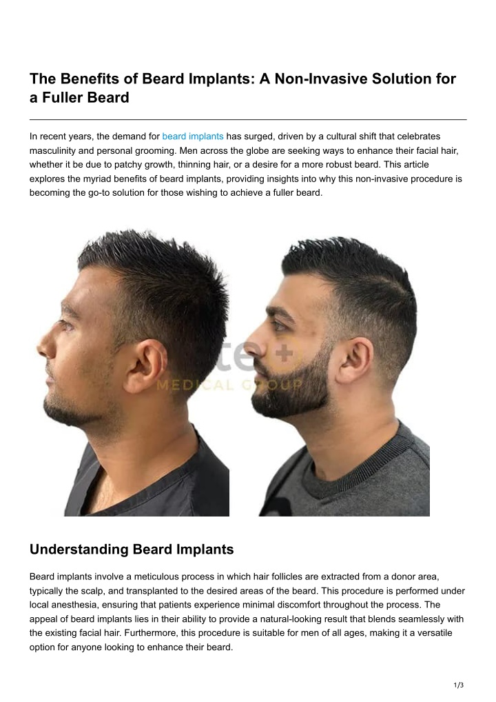 the benefits of beard implants a non invasive