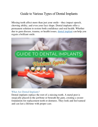 Guide to Various Types of Dental Implants