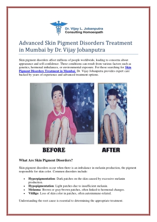 Advanced Skin Pigment Disorders Treatment in Mumbai by Dr. Vijay Jobanputra
