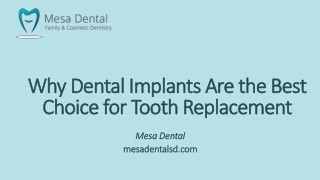 Why Dental Implants Are the Best Choice for Tooth Replacement