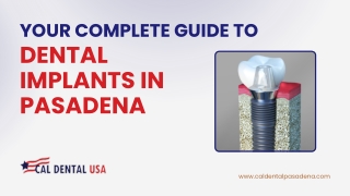 Your Complete Guide to Dental Implants in Pasadena