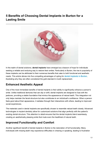 5 Benefits of Choosing Dental Implants in Burton for a Lasting Smile