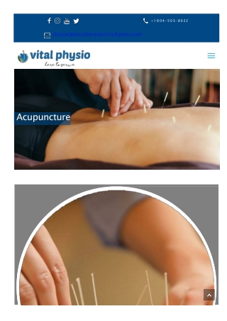 Acupuncture in Surrey, BC