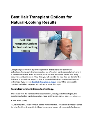 Best Hair Transplant Options for Natural-Looking Results (3)
