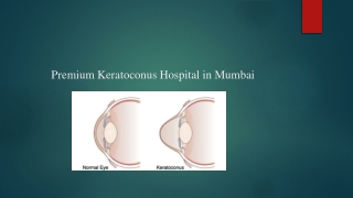 Premium Keratoconus Hospital in Mumbai