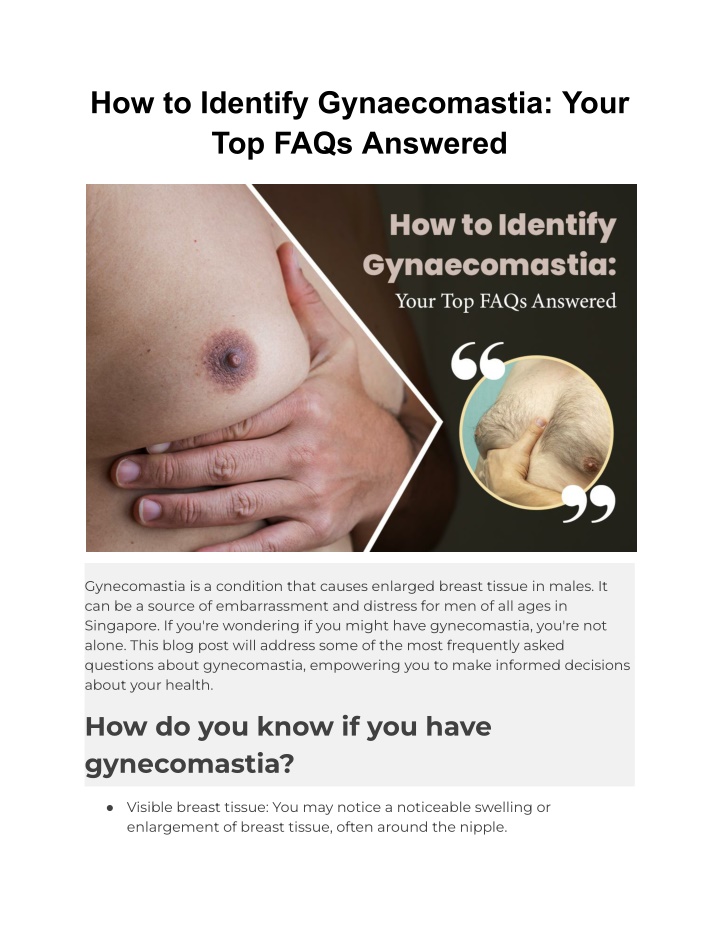 how to identify gynaecomastia your top faqs