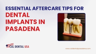 Essential Aftercare Tips for Dental Implants in Pasadena