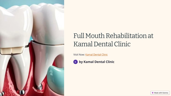 full mouth rehabilitation at kamal dental clinic