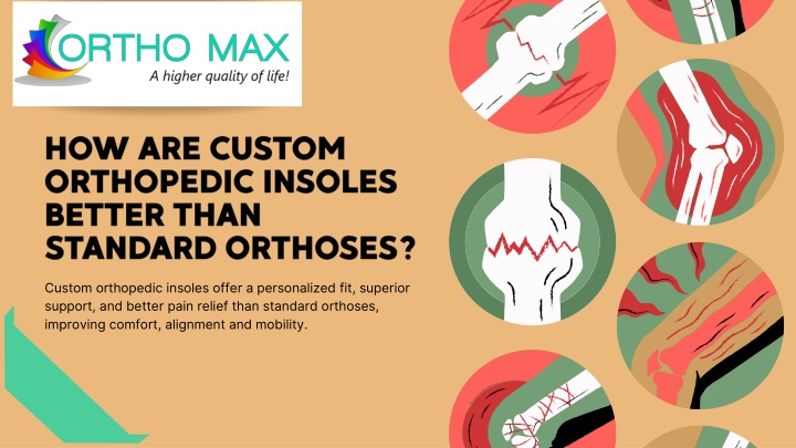 how are custom orthopedic insoles better than