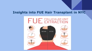 Insights into FUE Hair Transplant in NYC