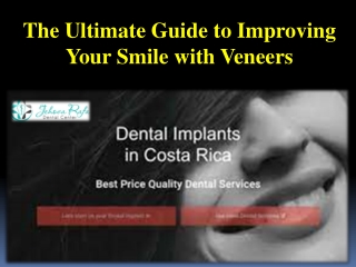 The Ultimate Guide to Improving Your Smile with Veneers