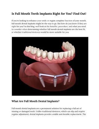 Is Full Mouth Teeth Implants Right for You
