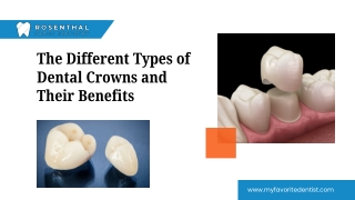 The Different Types of Dental Crowns and Their Benefits.