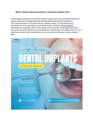 what is dental implants placement are dental