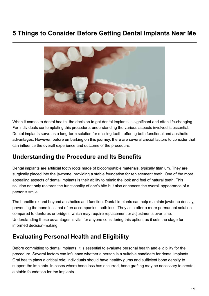 5 things to consider before getting dental