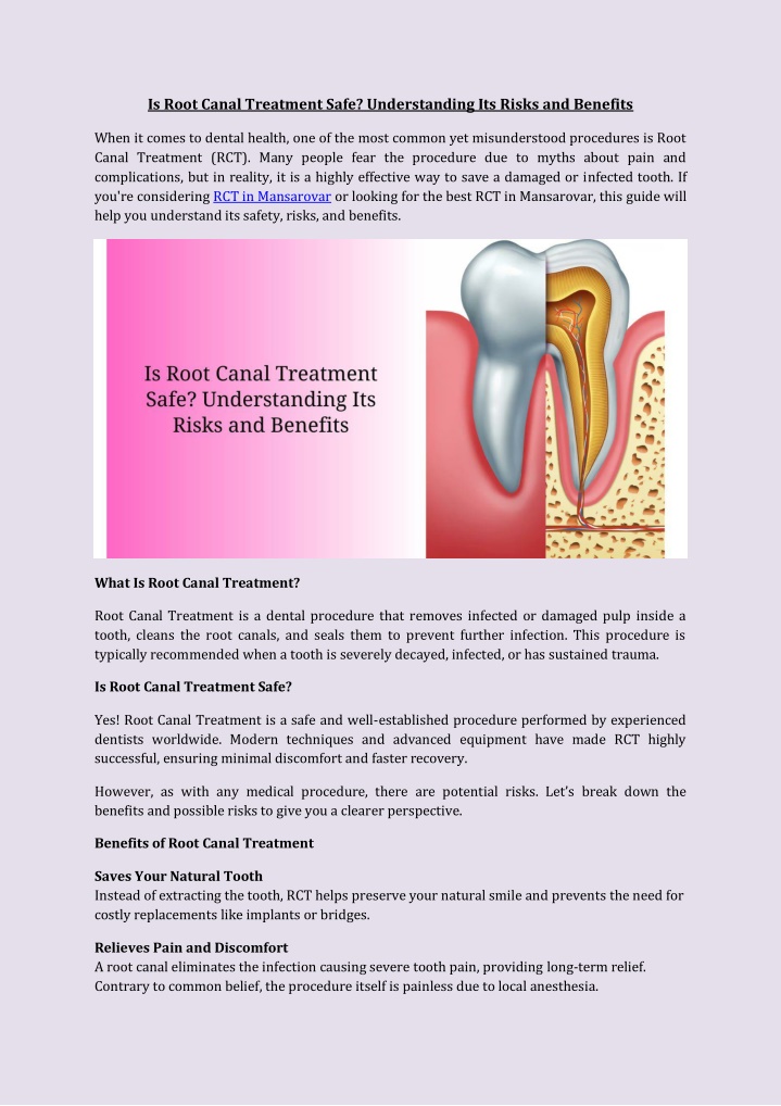 is root canal treatment safe understanding