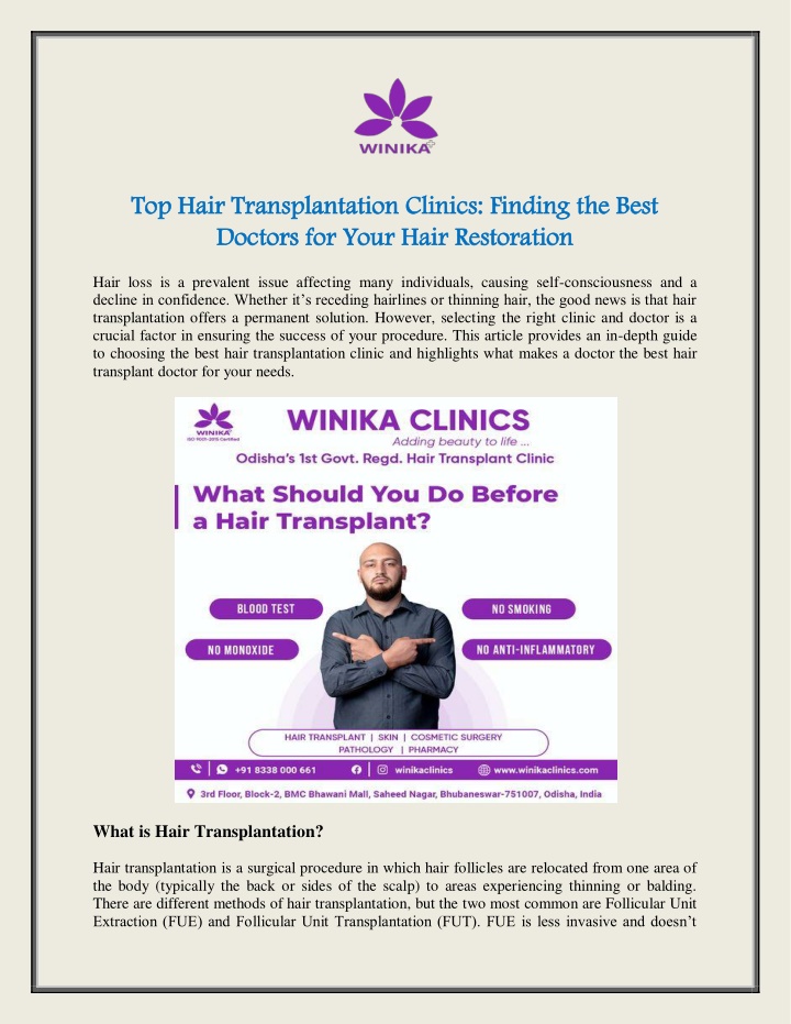 top hair transplantation clinics finding the best