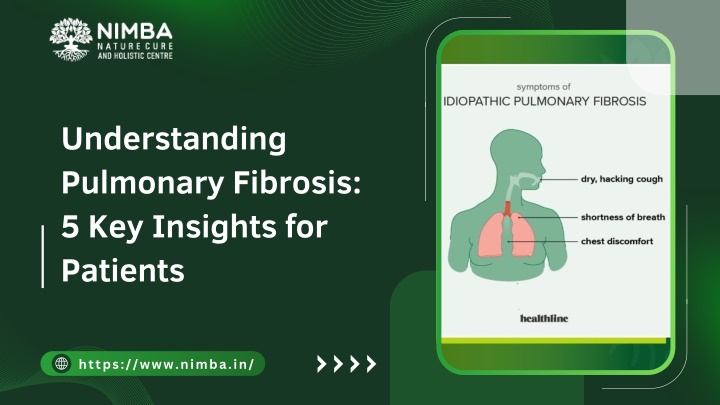 understanding pulmonary fibrosis 5 key insights