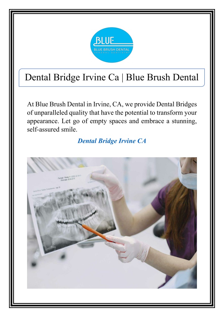 dental bridge irvine ca blue brush dental