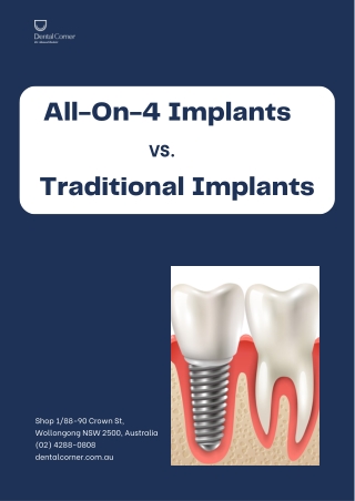 All-On-4 vs. Traditional Implants: Which Is Right for You?