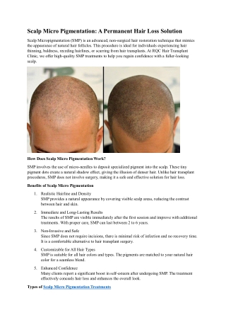 Scalp Micro Pigmentation A Permanent Hair Loss Solution