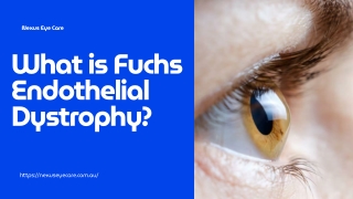 What is Fuchs Endothelial Dystrophy