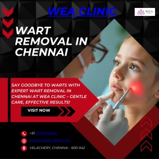 Wart Removal Chennai