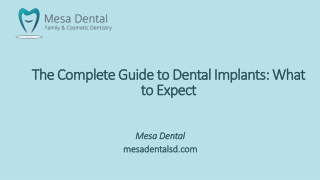 The Complete Guide to Dental Implants: What to Expect