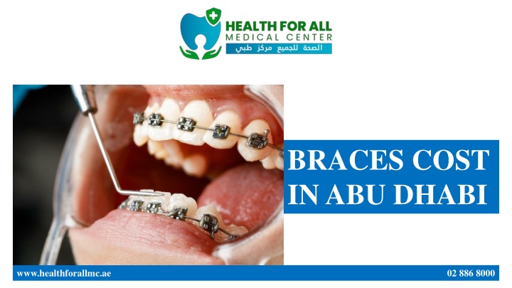 braces cost in abu dhabi