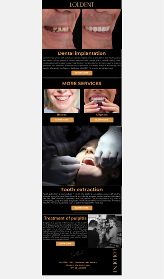 dental implantation