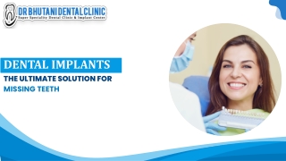 dental implants