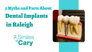 5 Myths and Facts About Dental Implants in Raleigh