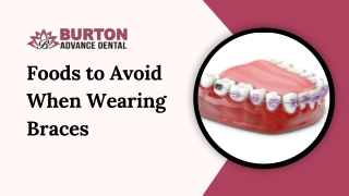 Foods to Avoid When Wearing Braces