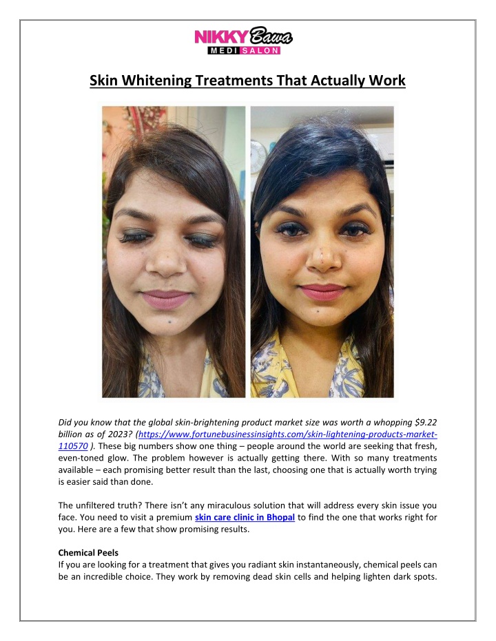 skin whitening treatments that actually work