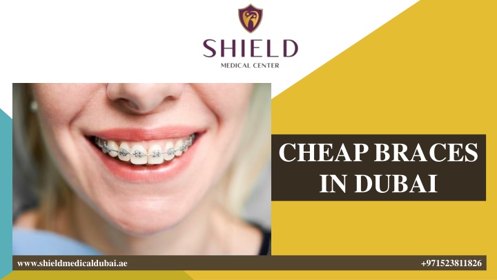 cheap braces in dubai