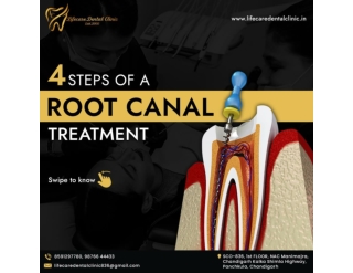 Affordable Root Canal Treatment in Panchkula - Life Care Dental Clinic