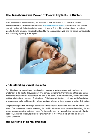 The Transformative Power of Dental Implants in Burton