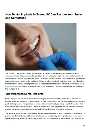 How Dental Implants in Essex, UK Can Restore Your Smile and Confidenc