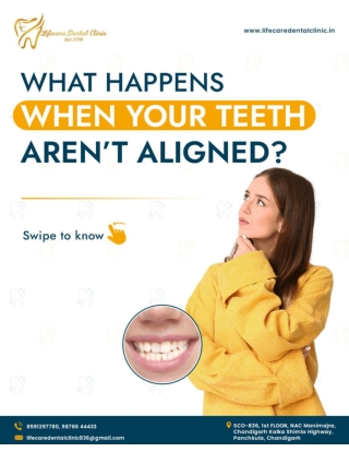 Let's Aligned Your Teeth With Our Best Orthodontist in Panchkula - Life Care Dental Clinic