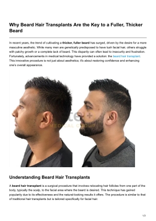 Why Beard Hair Transplants Are the Key to a Fuller Thicker Beard