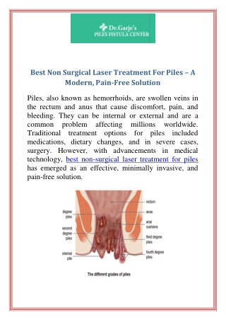 Best Non Surgical Laser Treatment For Piles  A Modern, Pain-Free Solution