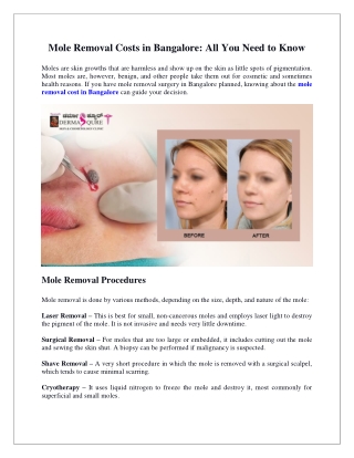 Mole Removal Costs in Bangalore All You Need to Know