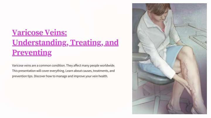 varicose veins understanding treating