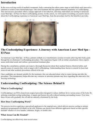 The Coolsculpting Experience: A Journey with American Laser Med Spa - El Paso