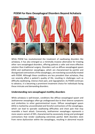 POEM For Rare Oesophageal Disorders Beyond Achalasia